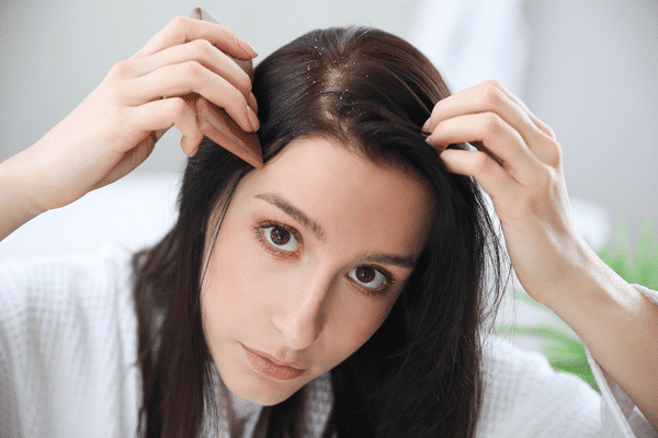 Lire la suite à propos de l’article Pellicules et cheveux : retrouver un cuir chevelu sain