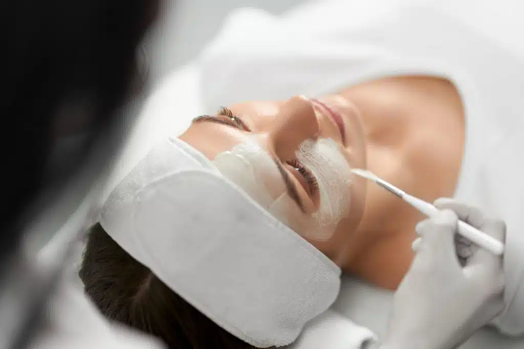 Traitement médical peeling à l'acide glycolique, acné, microkystes, comédons