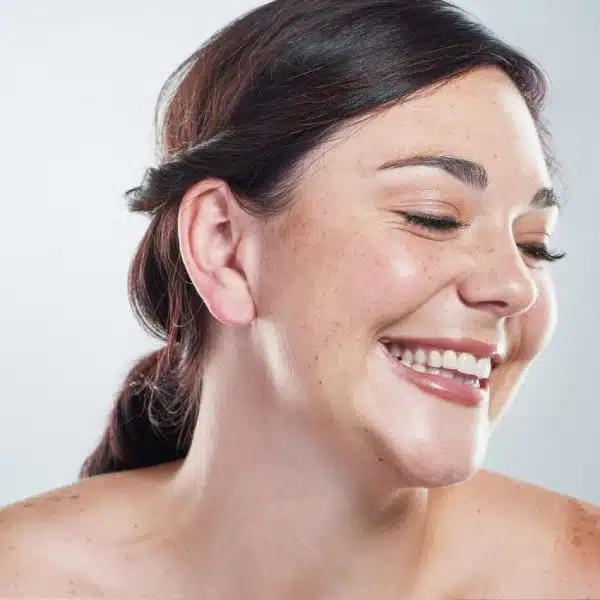 lentigos dues au soleil, taches de vieillesse, taches brunes, taches de soleil