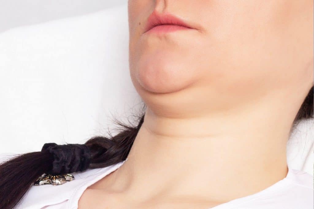Double menton nos conseils pour affiner votre profil