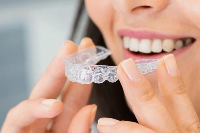 100 Aligneurs Dentaires à Mâcher - Pour Sièges, Récupération, Ajustement Des Gouttières