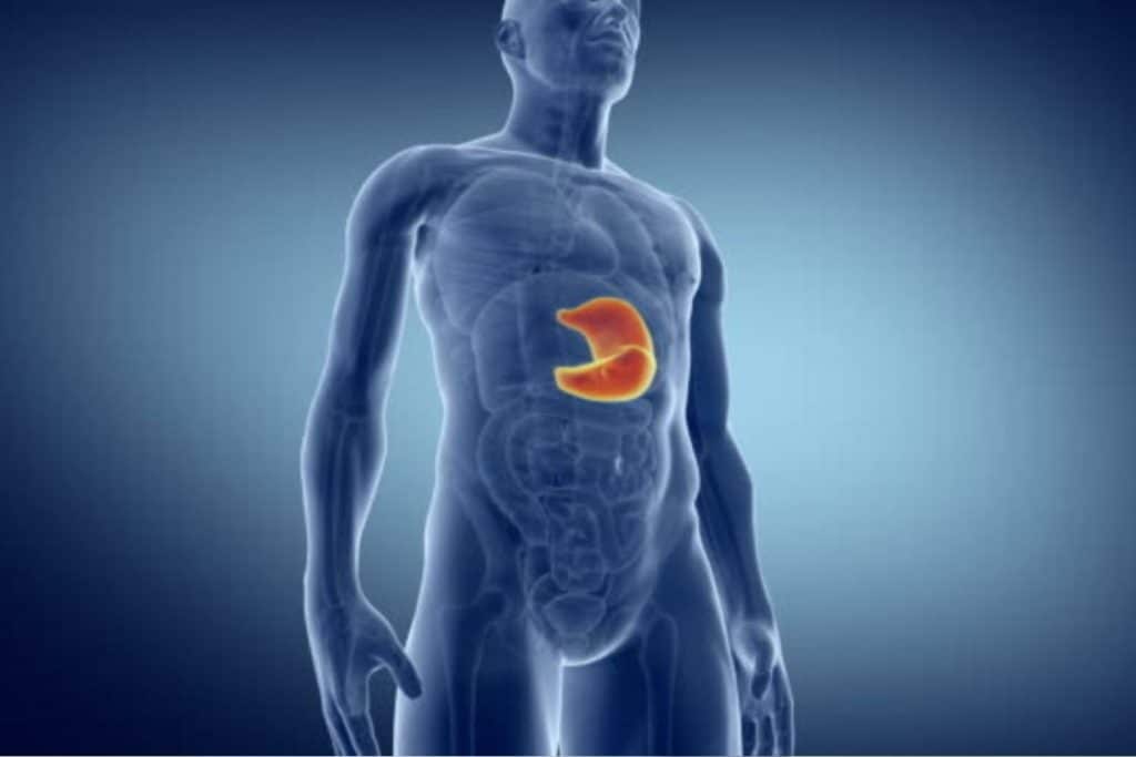 Sleeve Gastrectomie