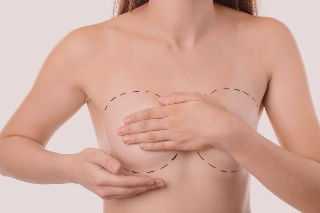 Augmentation mammaire, grosse poitrine, gros seins, beaux seins, poitrine généreuse (2)