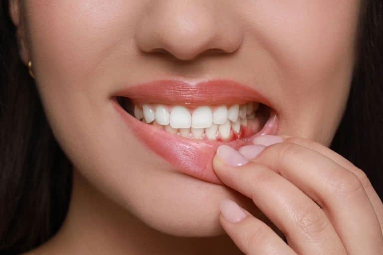 Lire la suite à propos de l’article Gencives enflammées : solutions efficaces pour des dents saines
