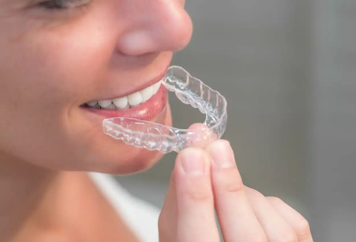 Options d'orthodontie pour adultes : aligneurs, bagues métal et céramique Aligneurs invisibles pour orthodontie adulte, comparaison avec bagues métal et céramique