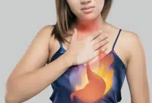 RGO, reflux gastro-œsophagien, reflux gastrique remède rapide symptômes gorge, reflux internes