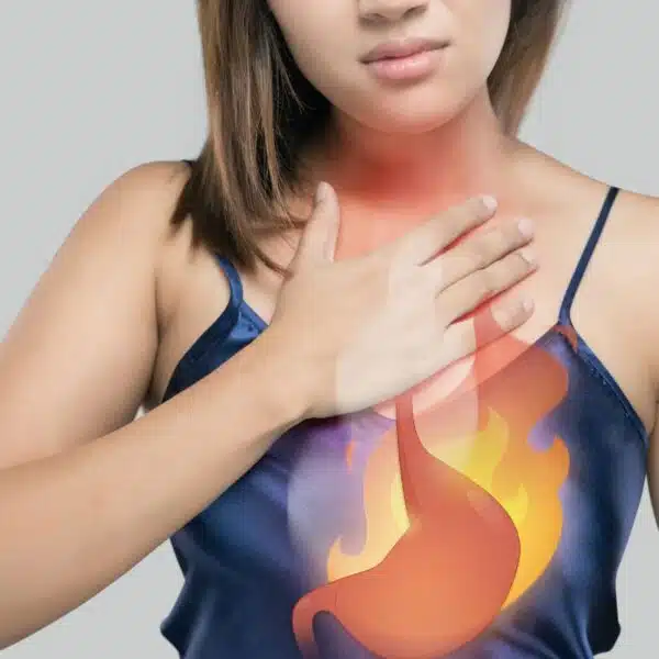 RGO, reflux gastro-œsophagien, reflux gastrique remède rapide symptômes gorge, reflux internes RGO, reflux gastro-œsophagien, reflux gastrique remède rapide symptômes gorge, reflux internes