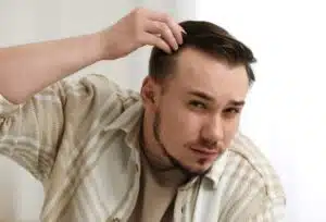 Calvitie comment identifier chaque étape, chauve, stade calvitie, greffe de cheveux, tonsure