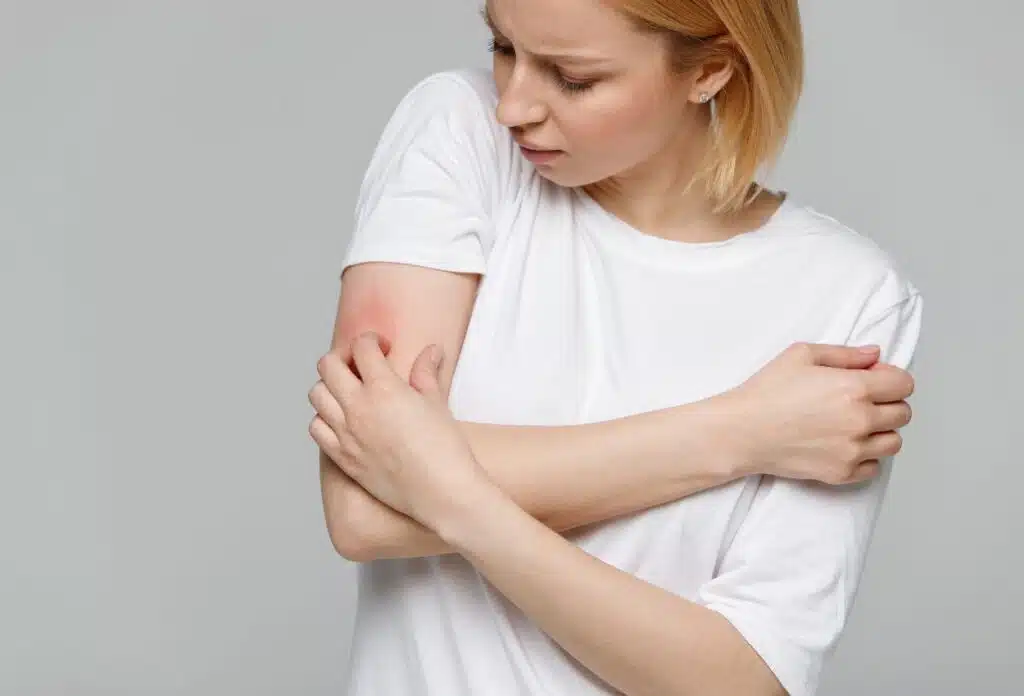 Peau très sèche, crème peau sèche visage, crème pour peau sèche, peau du visage sèche, peau qui sèche, peau sèche qui gratte