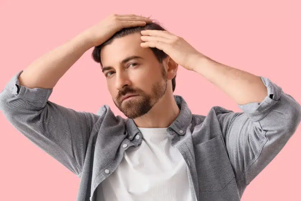 Greffe de cheveux est-ce vraiment la solution durable contre la calvitie alopécie, calvitie et chute saisonnière.