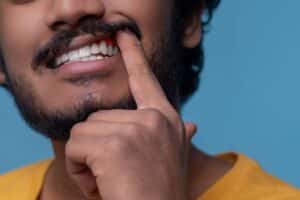 Gencives qui saignent, gencive gonflée, saignement au brossage, déchaussement des dents, dentiste, traitement des gencives, gingivite, infection des gencives, prévention dentaire, santé des gencives