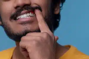 Gencives qui saignent, gencive gonflée, saignement au brossage, déchaussement des dents, dentiste, traitement des gencives, gingivite, infection des gencives, prévention dentaire, santé des gencives