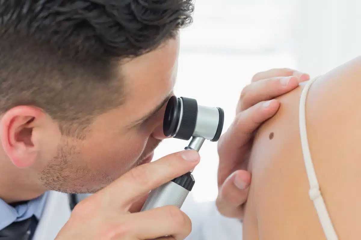 Grain de beauté qui gratte les signaux à ne pas ignorer. Les vraies causes, quand agir sans attendre, faut-il consulter, danger ou banalité, Grain de beauté qui gratte les signaux à ne pas ignorer. Les vraies causes, quand agir sans attendre, faut-il consulter, danger ou banalité,