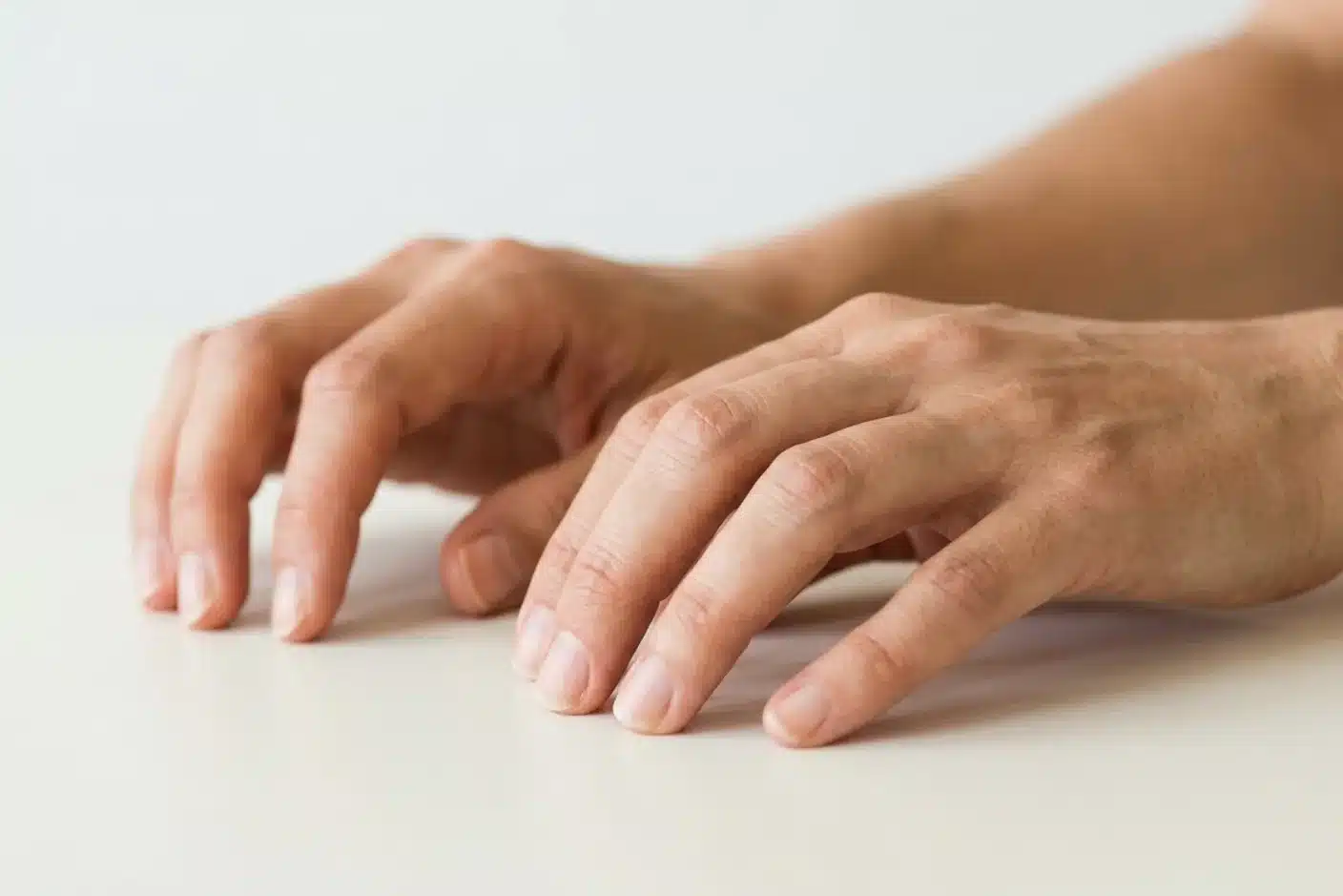 Contracture des mains lors d'une crise de spasmophilie Gros plan de mains présentant une légère contracture musculaire, symptôme d'une crise de spasmophilie