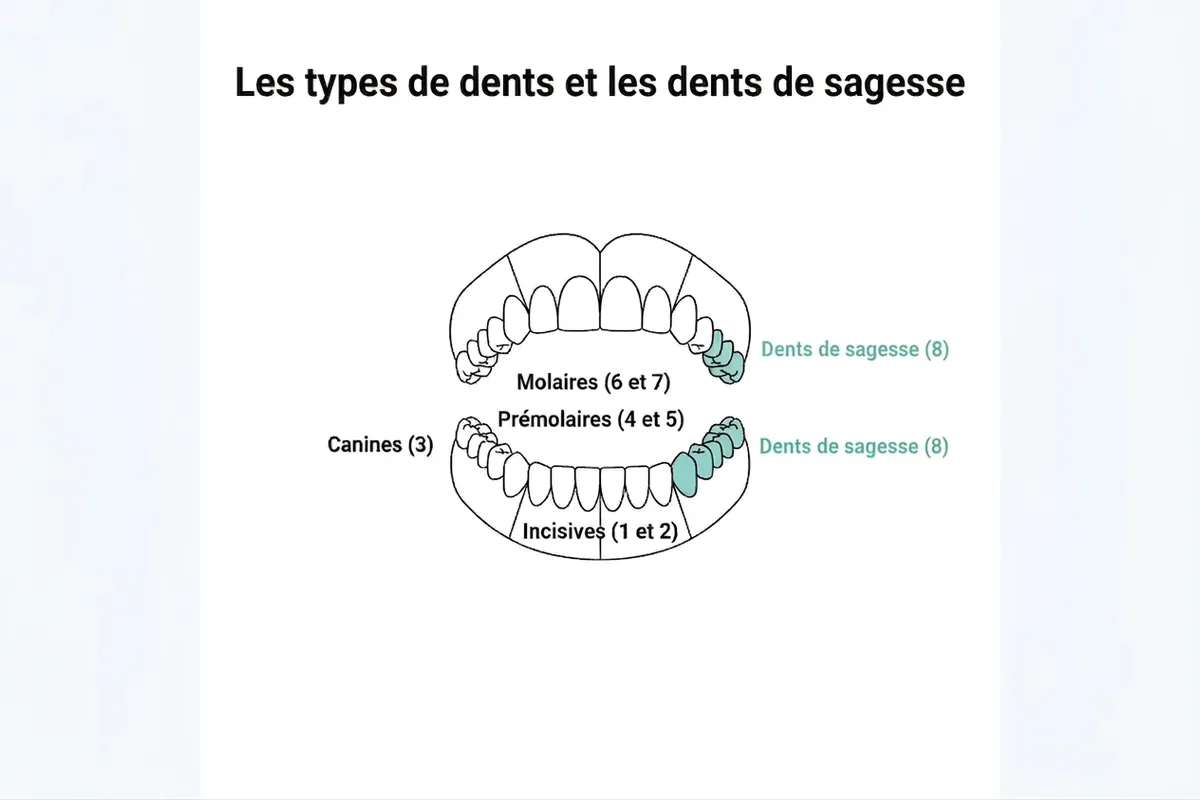 Les types de dents et les dents de sagesse Schéma de l’arcade dentaire adulte situant les dents de sagesse (numéro 8)