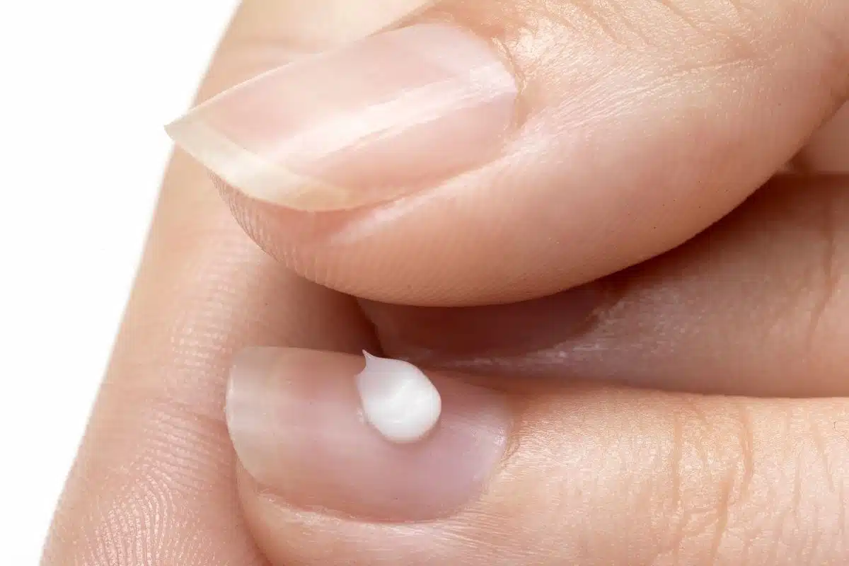 Ongle strié avec soin nourrissant gros plan d'un ongle strié verticalement avec une noisette de crème de soin