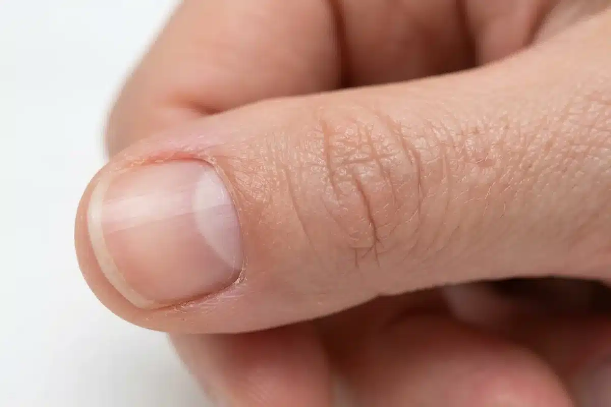 Lunule de l'ongle : vue macro sur la base du pouce Macro de la base d'un ongle de pouce montrant la lunule blanche en demi-lune, fond blanc clinique