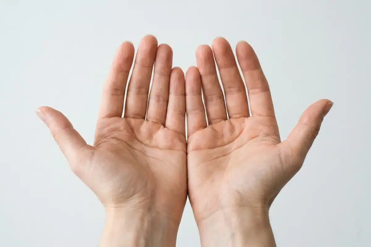 Mains tendues paume vers le haut, examen clinique des ongles Mains tendues paume vers le haut sur fond blanc, examen clinique des ongles permettant de détecter des signes de maladies systémiques