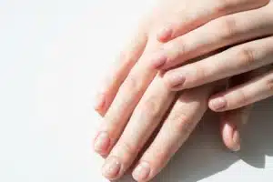 Gros plan de mains féminines aux ongles présentant de légères taches blanches (leuconychie) sur fond blanc épuré